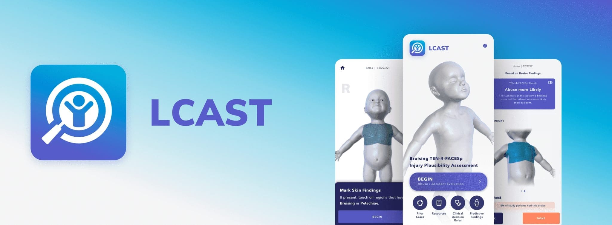 LCAST - Blog Header